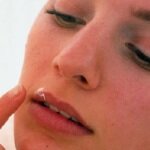 Народные средства от герпеса на губах — профилактика и лечение вирусного заболевания